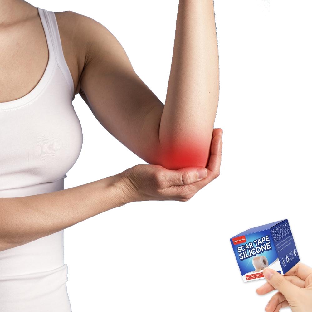 Medical Silicone Scar Patch 4cmx150cm, Professional Scar Repair Patch, Cesarean Section Scar Fade Patch, Adjustable Reusable