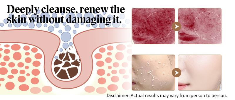 [JSNR Official]  Glow Corn Enzyme Ampoule Duo  Deep Clean, Brightening & Moisturizing Serums | Gentle Face & Body Blackhead Remover- Suitable for All Skin Types Cleansing Exfoliant- empties  , Exfoliation  Moisturizer   100ml