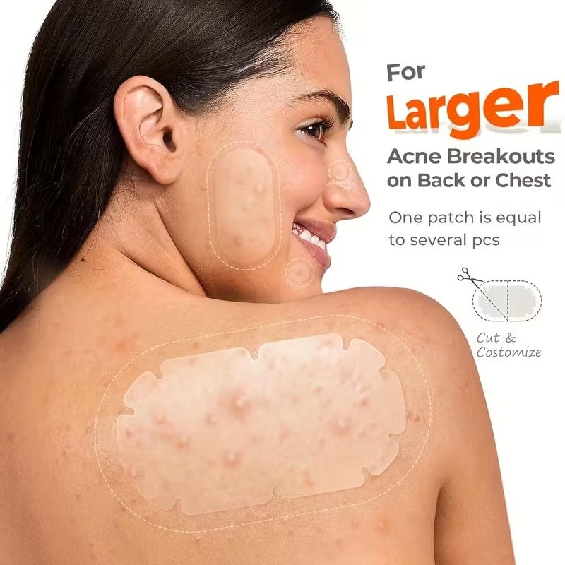 104pcs Acne Patches, Acne Pimple Patch, 5 Shapes, Hyaluronic Acid & Tea Tree Oil, Day and Night Skin Care, Transparent Gel, Anti-Acne Treatment