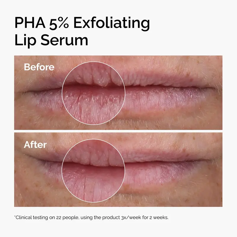 PHA 5% Exfoliating Lip Serum