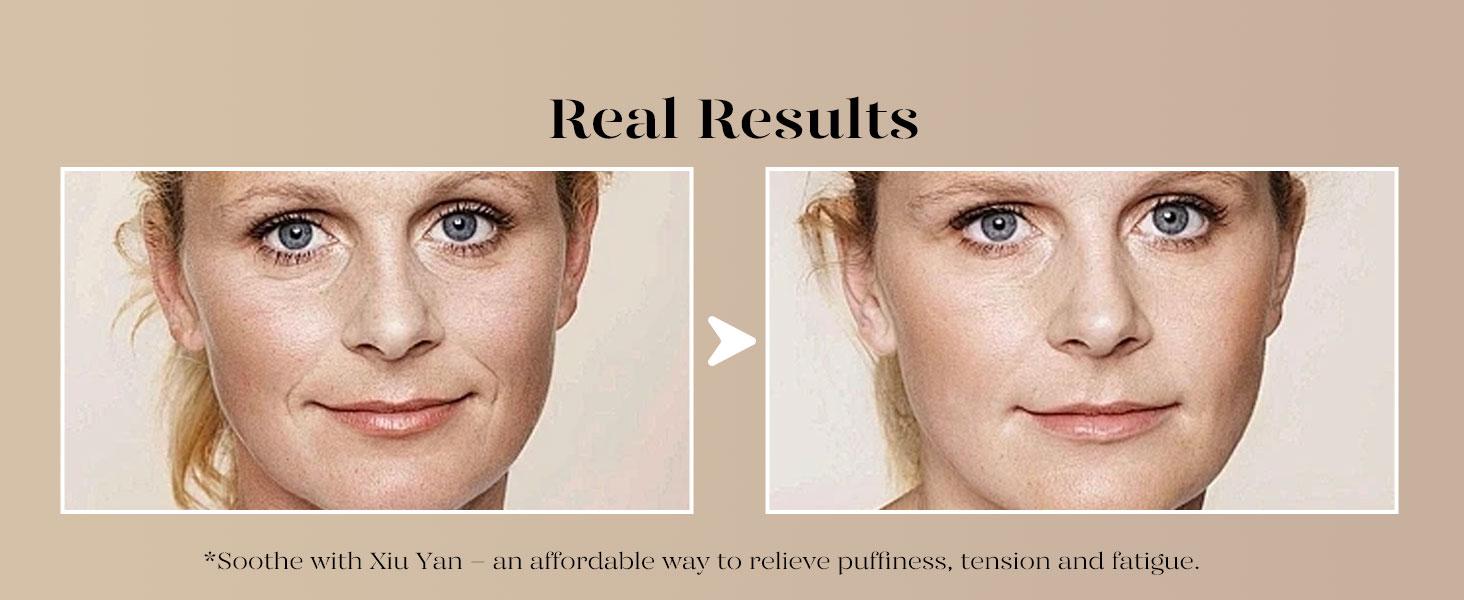 BAIMEI IcyMe Gua Sha & Jade Roller Facial Tools, Face Roller and Gua Sha Set for Puffiness, Self Care Gift