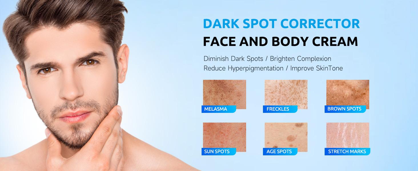 HANYWIL Dark Spot Corrector Cream with Retinol & Vitamin C - Visibly Reduce Dark Spots & Brighten Skin Tone for Face & Body - All Skin Types - 2 oz - Gentle