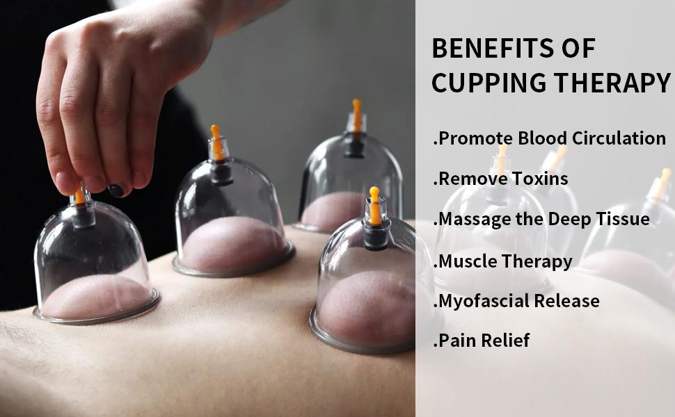 Cupping Set, 6 Cups Cupping Kit for Massage Therapy, Chinese Cupping Therapy Set with Magnetics, Professional Vacuum Cupping Set for Cellulite Reduction Muscle Pain Relief with Manual Pump