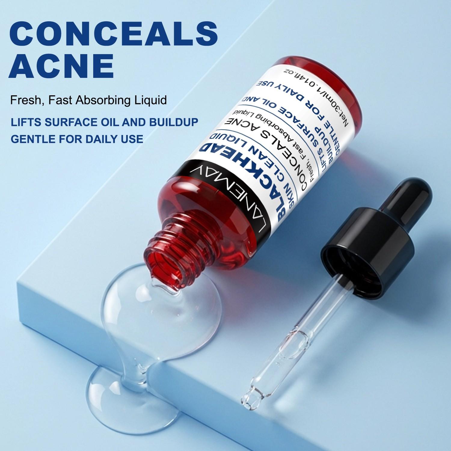 30ml Multi-Acid Blackhead Cleanser | Salicylic Acid + Succinic Acid + Niacinamide + Lactobionic Acid softens blackheads and fades blemishes from the root | Gentle formula suitable for daily use, improves roughness, and refines skin.