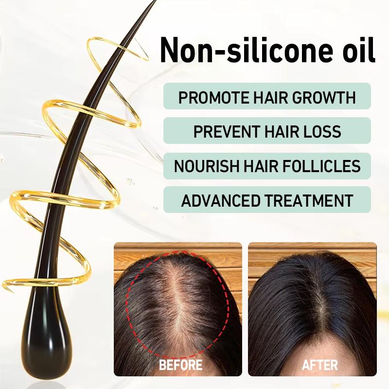 LANYAN 120ML Scalp Stimulating Hair Growth Oil, Light Mint & Peppermint Blend, Promotes Fuller Thicker Hair, Supports Hair Loss Repair