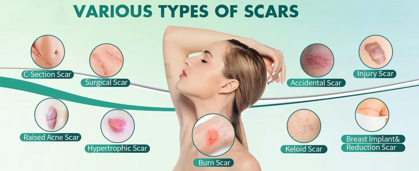 PUMKOT Professional Scar Beauty Set | Silicone Scar Sheets+ Retinol Hydrating Firming Cream(Scar Cream) | Firming, moisturizing, facial care,Skin Care Tools Recommended by Koreans