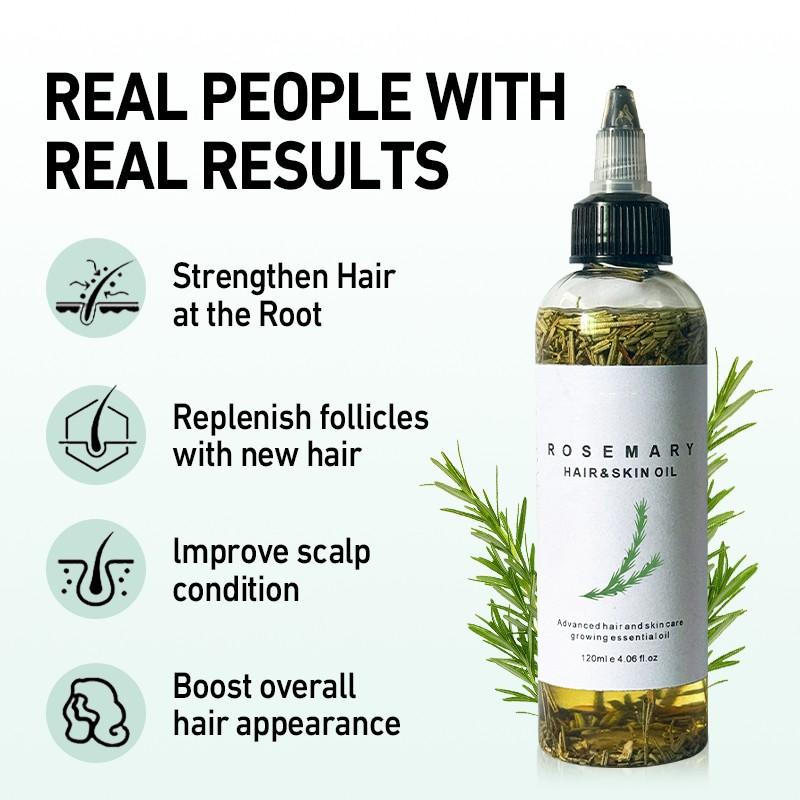 LANYAN 120ML Scalp Stimulating Hair Growth Oil, Light Mint & Peppermint Blend, Promotes Fuller Thicker Hair, Supports Hair Loss Repair