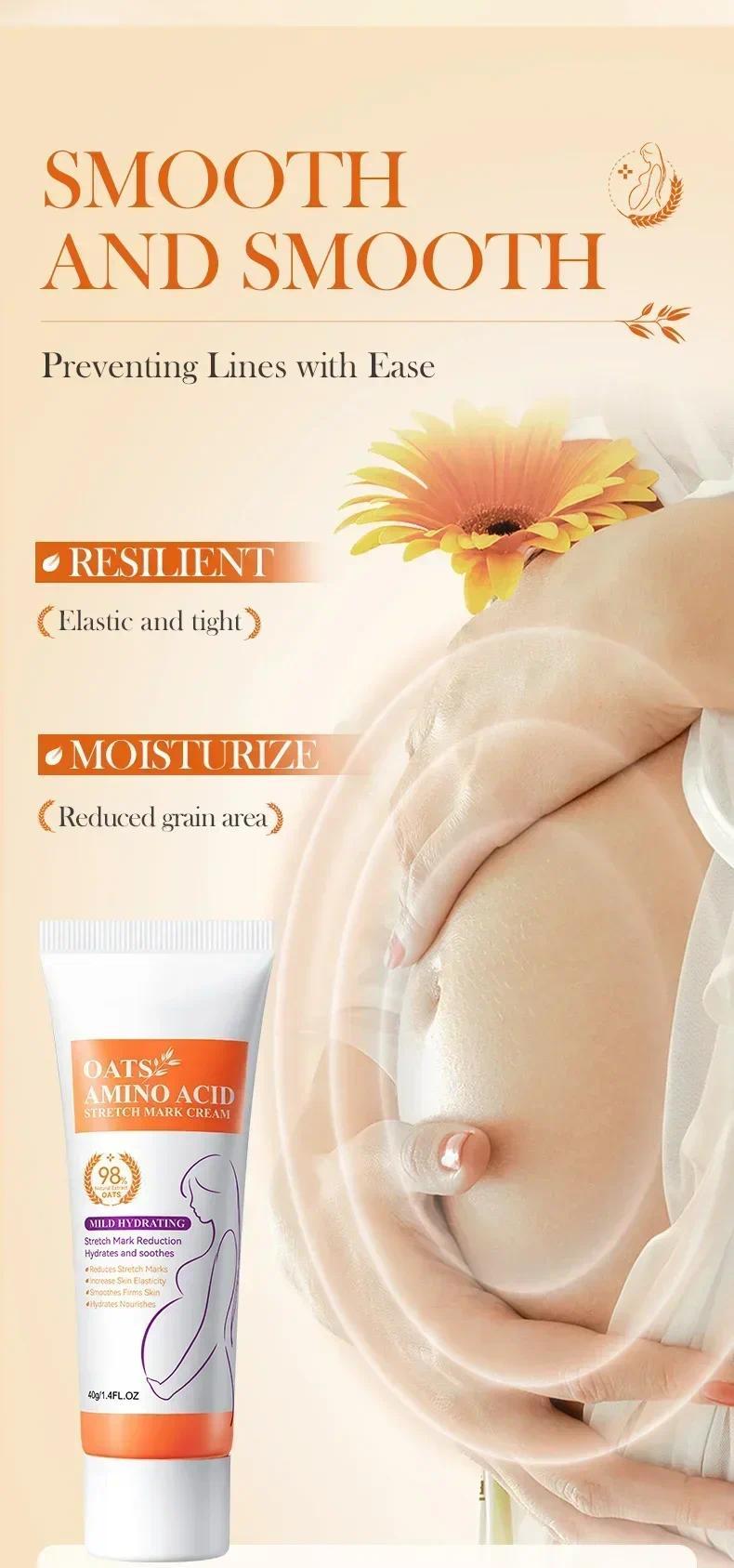 HOT SALE Stretch Marks Permanent Removal Eliminate Body Belly Stretch Marks Swelling Marks Remove Skin Cracks Repair Firming Car