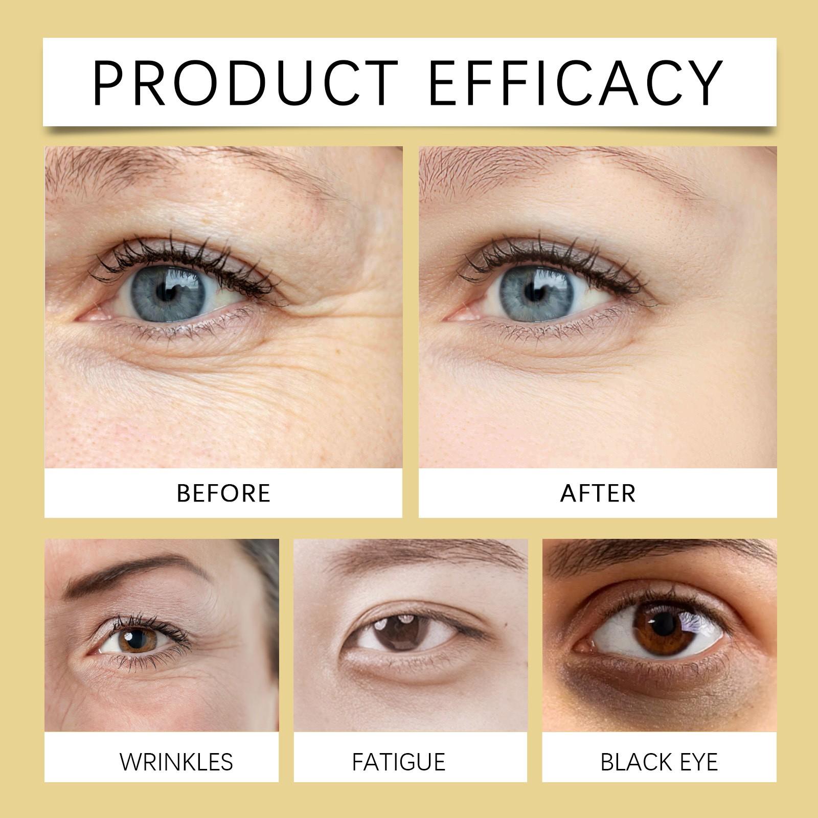 Castor Oil Eye Serum Anti-Wrinkle Remove Dark Circles Eye Bags Anti-Puffiness Lift Firm Ball Massage Moisturize Nourish Eye Care