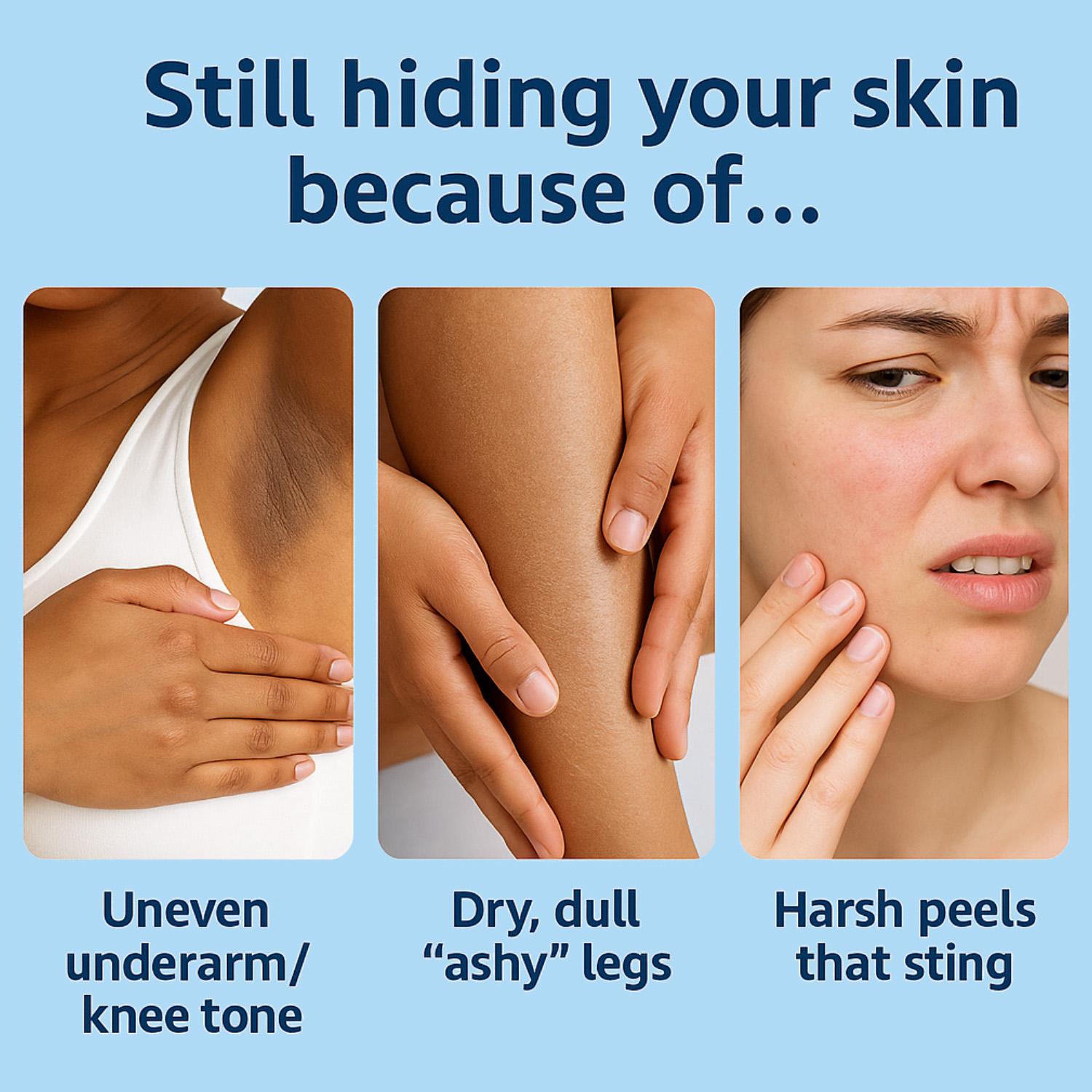 Jelly Booster Pigment Treatment Body Potion Scar Treatment - Fast Absorbing Acne Scar for Face And Body - Scar Removal Ointment - Lightweight Scar Serum for Everyday Use - 100ml