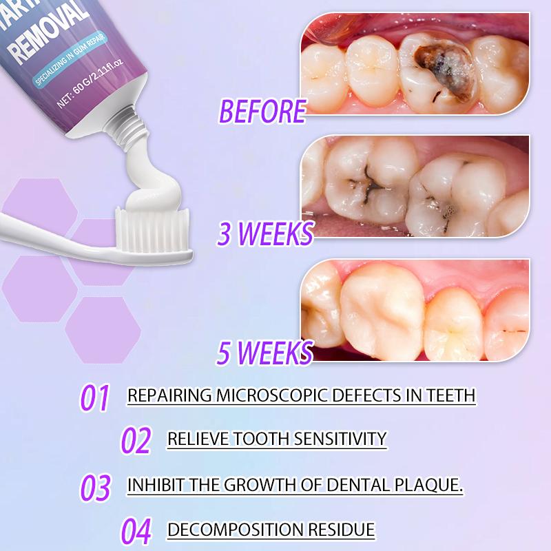 Deep Clean Anti-Cavity Toothpaste, Total Mouth Protection for Cavity ...