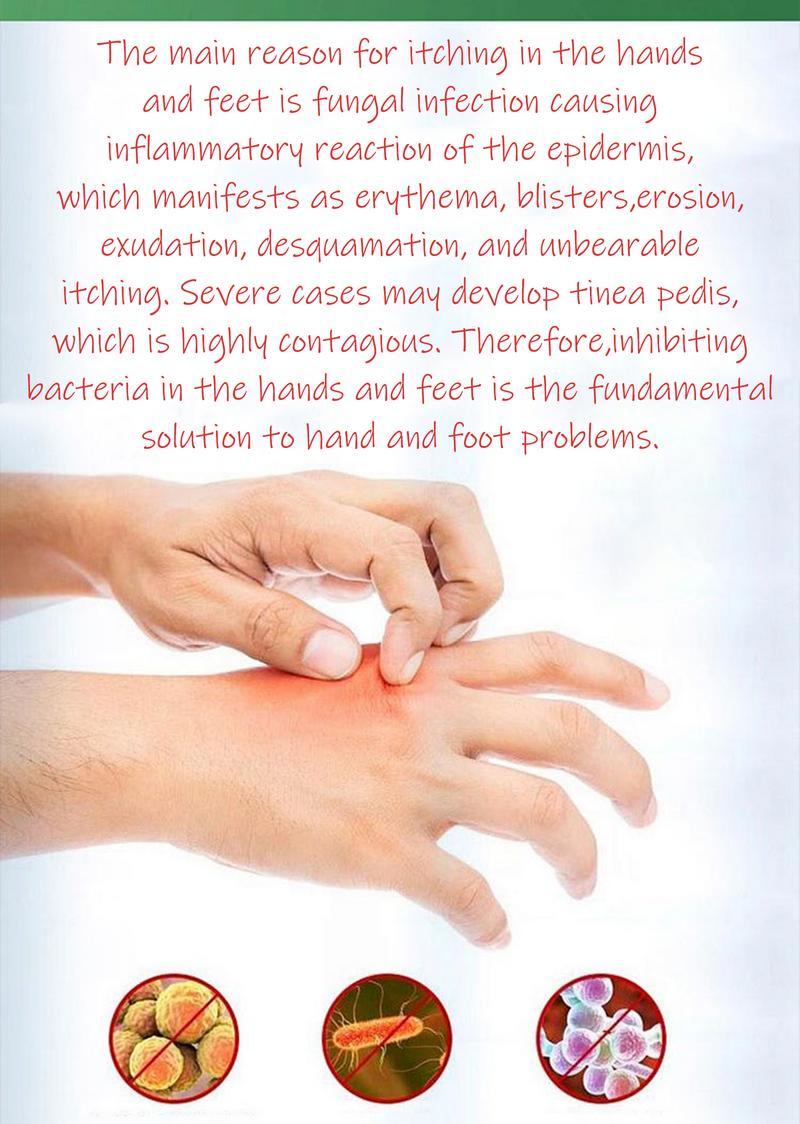 Cream for Eczema & Psoriasis,All-Natural Soothing Cream  – Best Gift,Herbal Relief for Dry, Itchy, Sensitive Skin , Anti-Bacterial Skin Defense (Hydrating, Safe for All Ages | 20g) Treatment