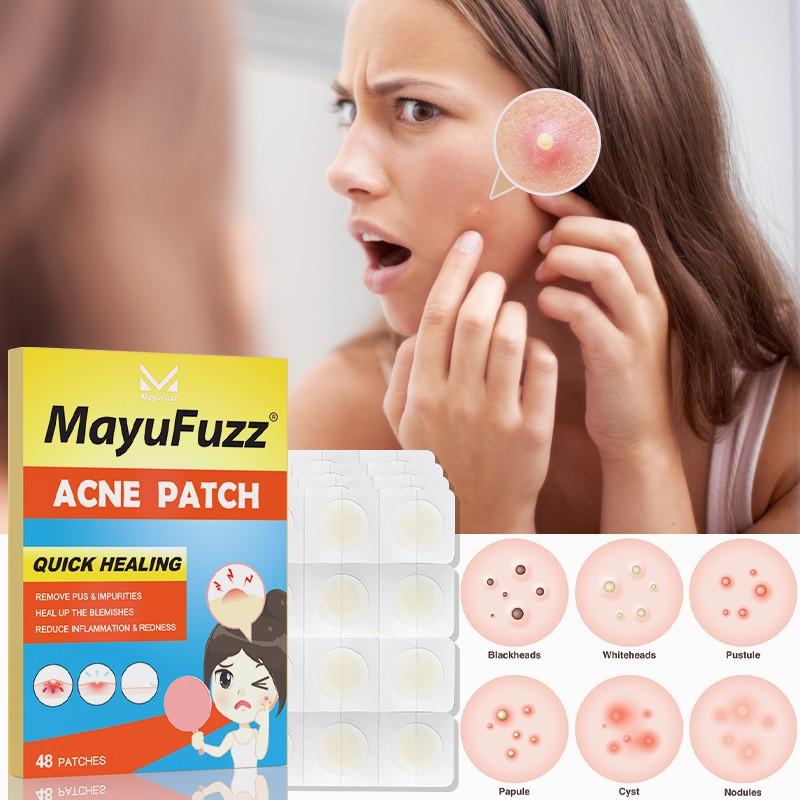 Acne Patches for Blemish Cover, Invisible Spot Care Stickers for Clear Skin, Daily Skincare Pimple Patches for Effective Care