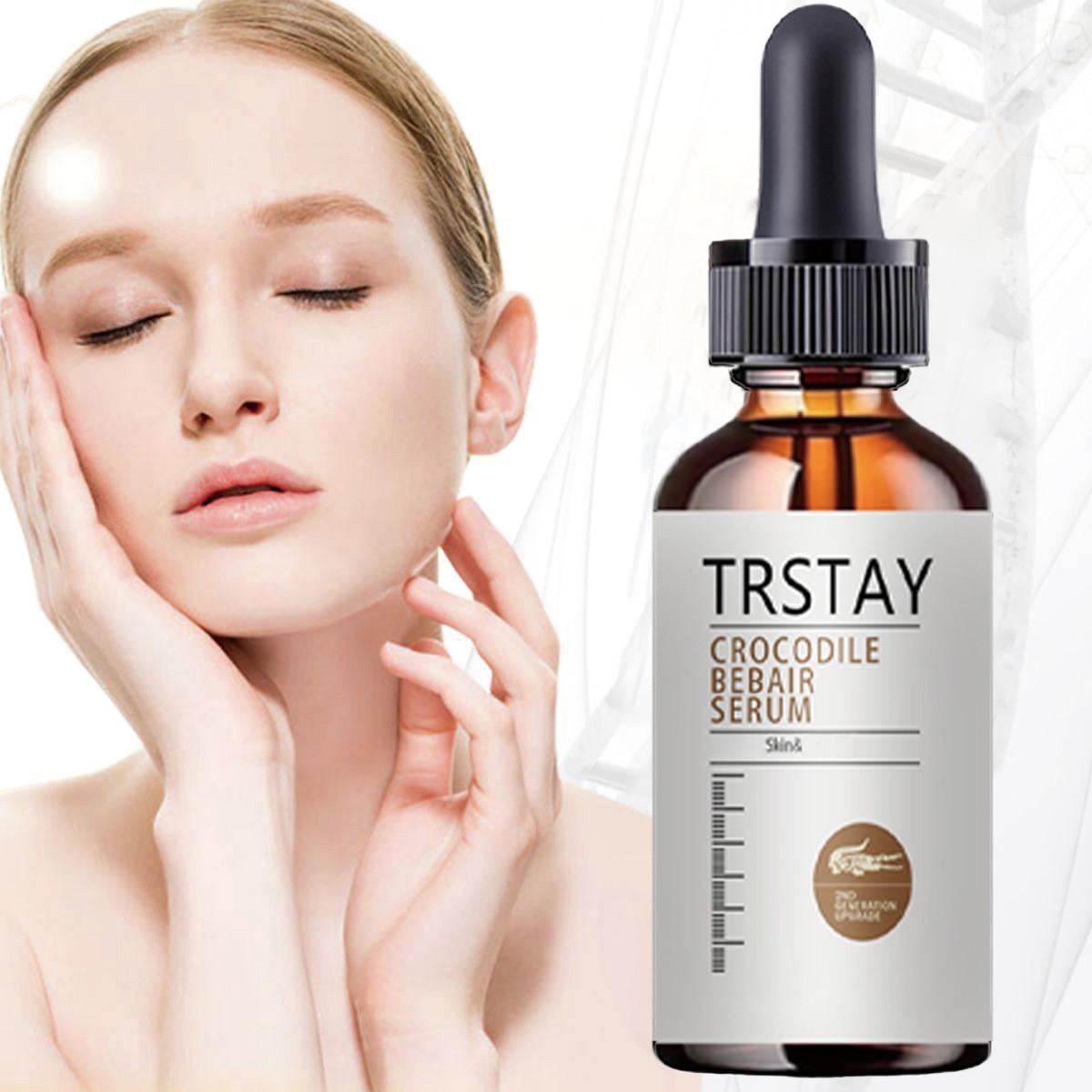 Trstay Facial Serum with Witch Hazel & Arbutin, Moisturizes, Soothes Irritated Skin, Minimizes Pores, Fades Pigmentation, Brightens Complexion