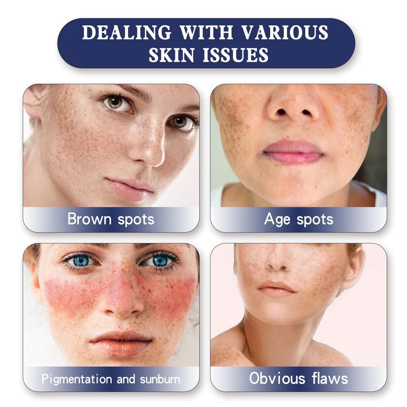 HOYGI Skin Genesis Spot Whitening Cream Brightening Firming Soothing - Niacinamide & Arbutin Dark Spot Corrector for Even Skin Tone HOYGI Skin Genesis Spot Whitening Cream Brightening Firming Soothing - Niacinamide & Arbutin Dark Spot Corrector for Even Skin Tone