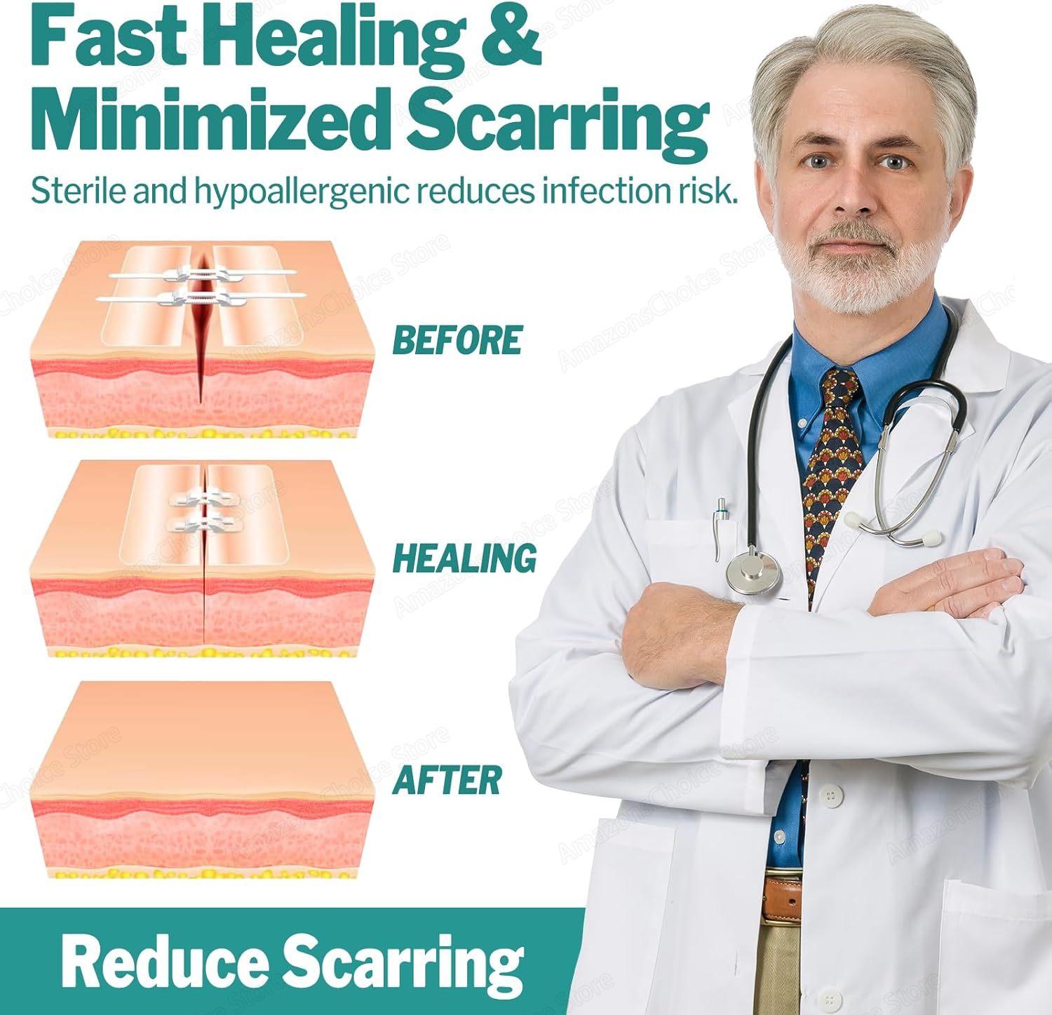 Sanke Rescue 14/28 Pack Wound Closure Strips Zipper Bandages Emergency Laceration Closure Kit Repair Wounds Closures Device