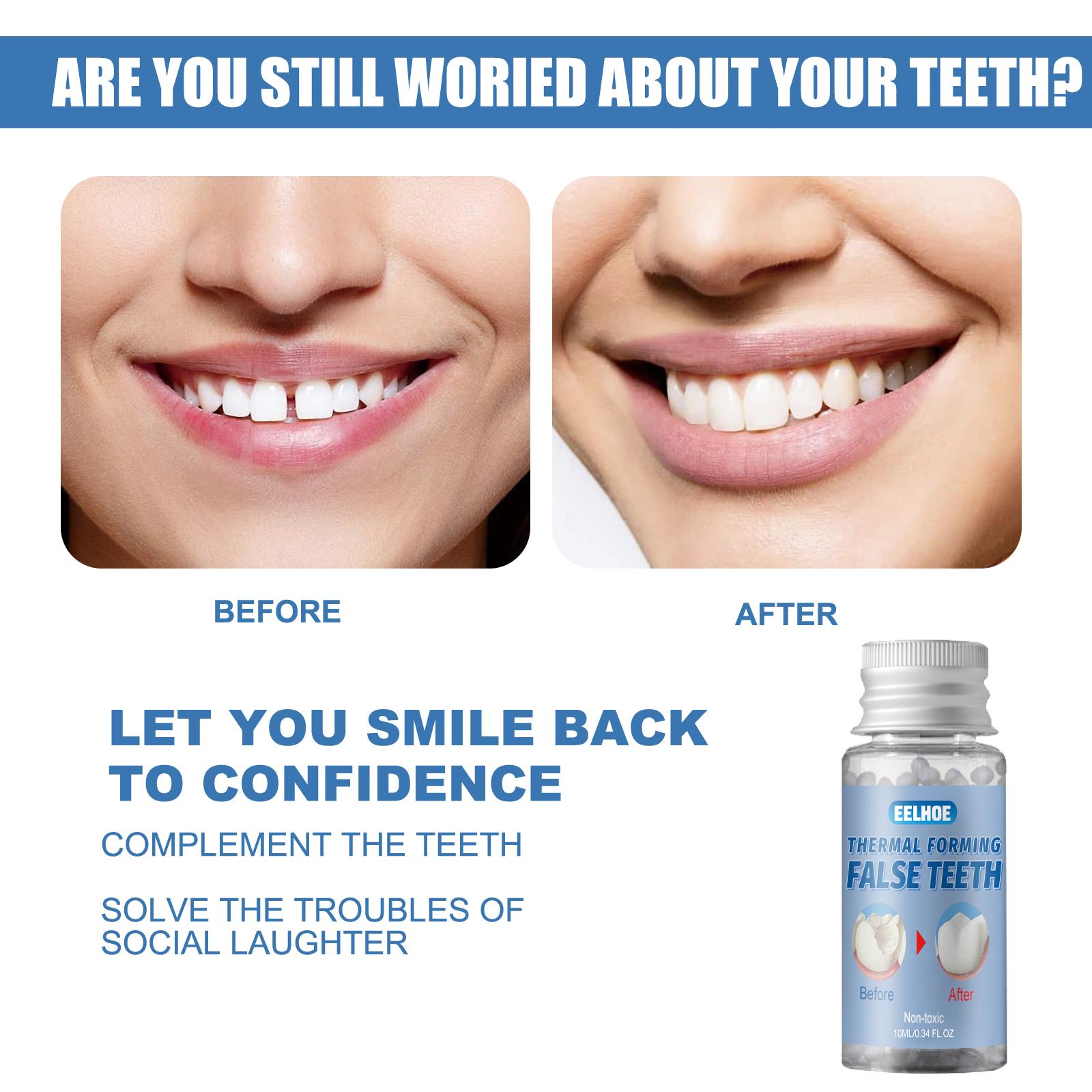 Moldable Dental Gel Dentures Temporary Fillings Cavities and Teeth Fillings Temporary Tooth Filling-1 pcs