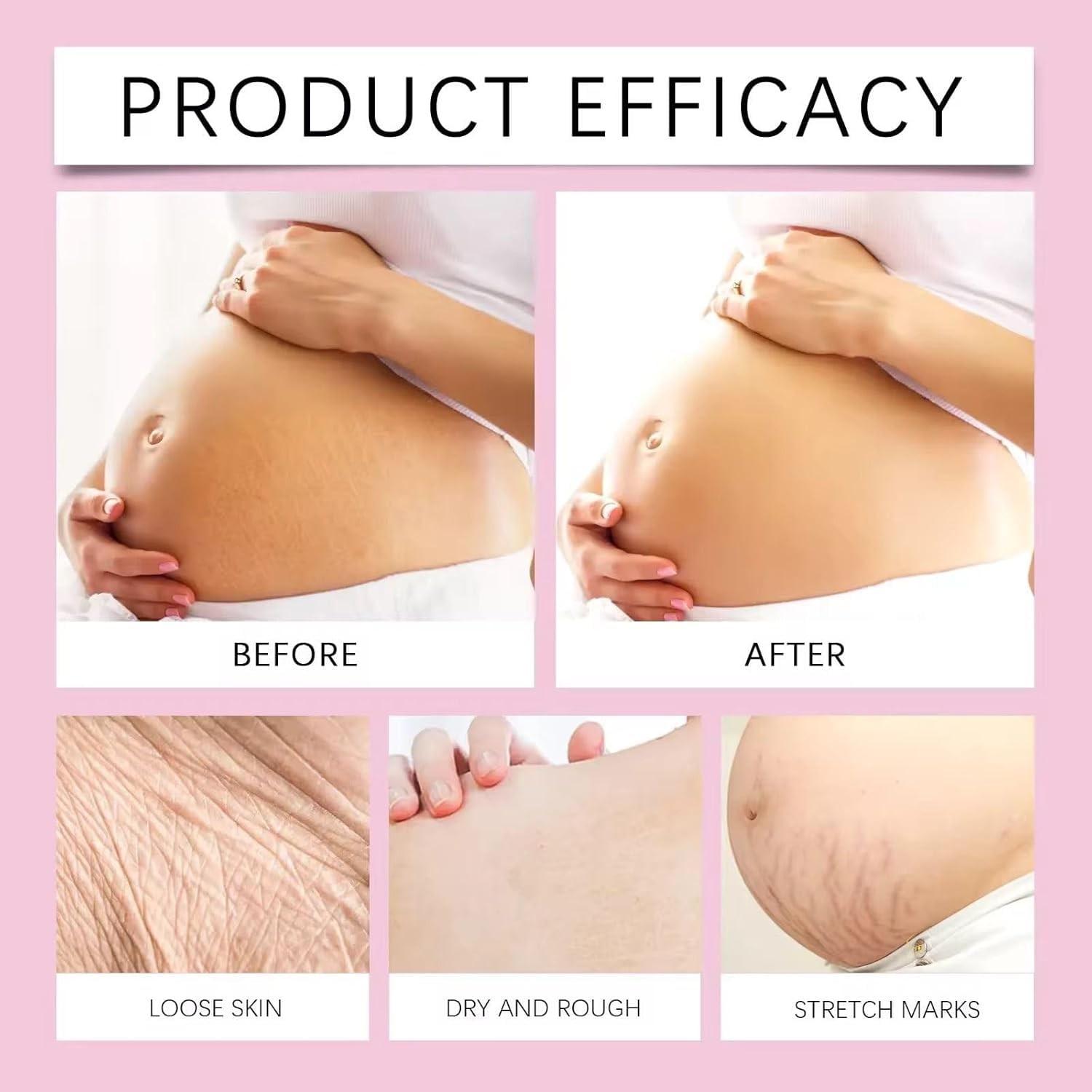 Gentle Repair Cream, Massage Balm, Firming Cream, Anti Stretch Marks, Reduces Stretch Marks, Prevents Pregnancy Belly Lines, Postpartum Recovery, Deep Moisturizing, Stretch Mark Cream For Pregnancy