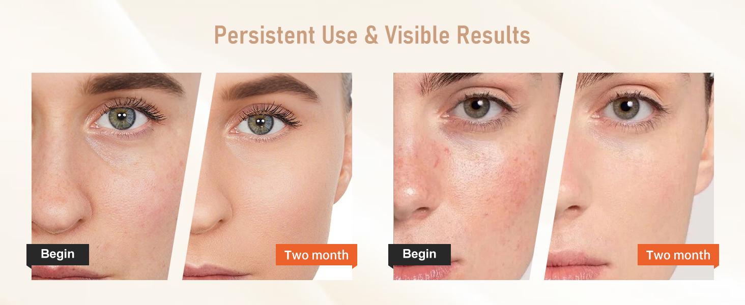 Red Light Therapy for Face, 7 Modes Portable Led Face Mask Light Therapy with Remote Control, LEDs face mask & neck mask Red,Advanced Skincare Made Easy,Timing Function, Red Light Therapy at Home Facial Glow