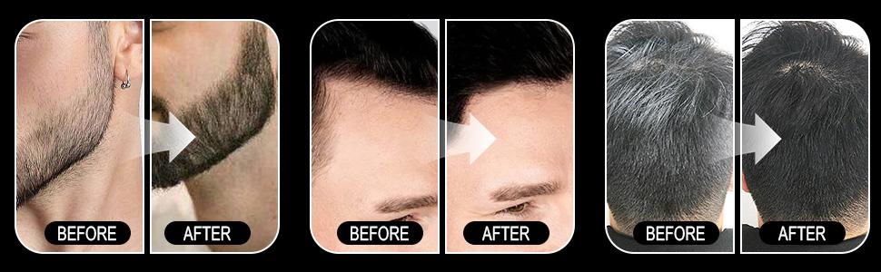 Hairline Powder for Bald Spots, Eyebrows, Beard Line, Light-Blonde Hair Fibers for Thinning Hair Shadow Powder Root Cover Up (Black) Haircare Cosmetic