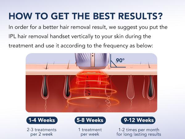 SKG Hair Freedom System, Dual-Pulse IPL for Contact-Free Hair Removal, Infinite Flashes, 25-Minute Full-Body Solution Electric Epilator Manual Epilator