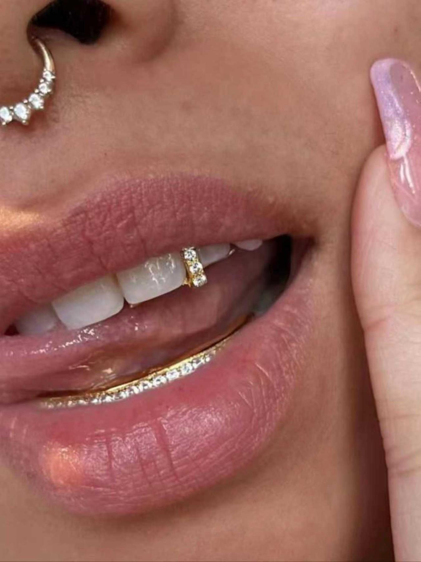 1 punk hip-hop dental accessory, shiny and detachable rhinestone braces, gemstone teeth, gold and silver colors, fun single clip style dental accessory