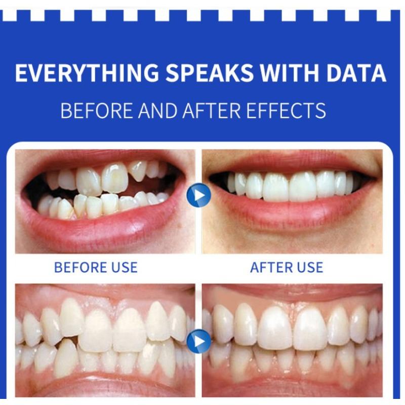 Silicone orthodontic braces Product with Storage Case, Comfortable to Wear, Safe to Use, Suitable for Both Men and Women