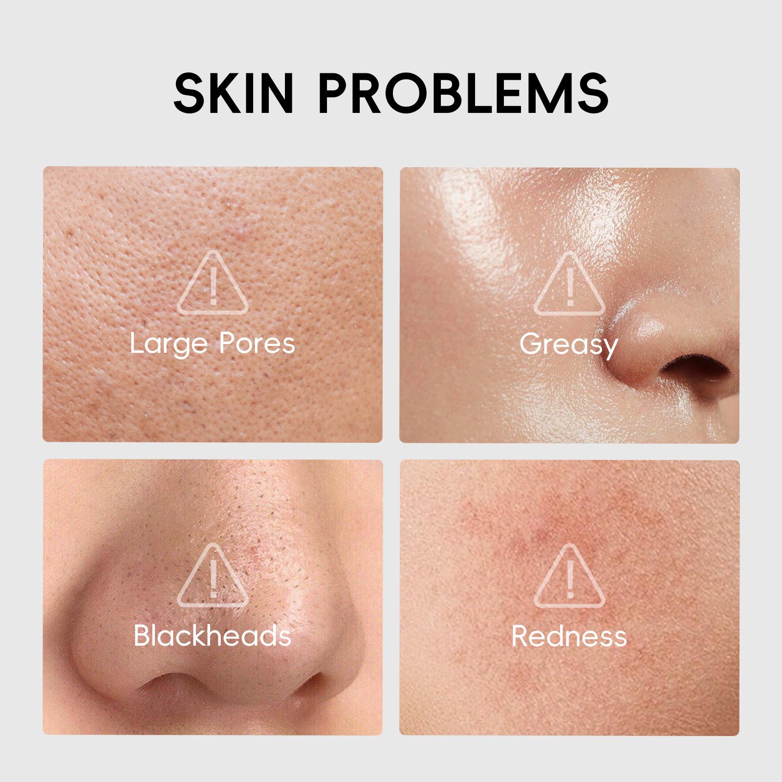 Charcoal Purifying Facial Mask, 10pcs/set Oil Control & Pore Care Facial Mask, Moisturizing Facial Skin Care Mask for Women & Men, Hydrating Face Mask