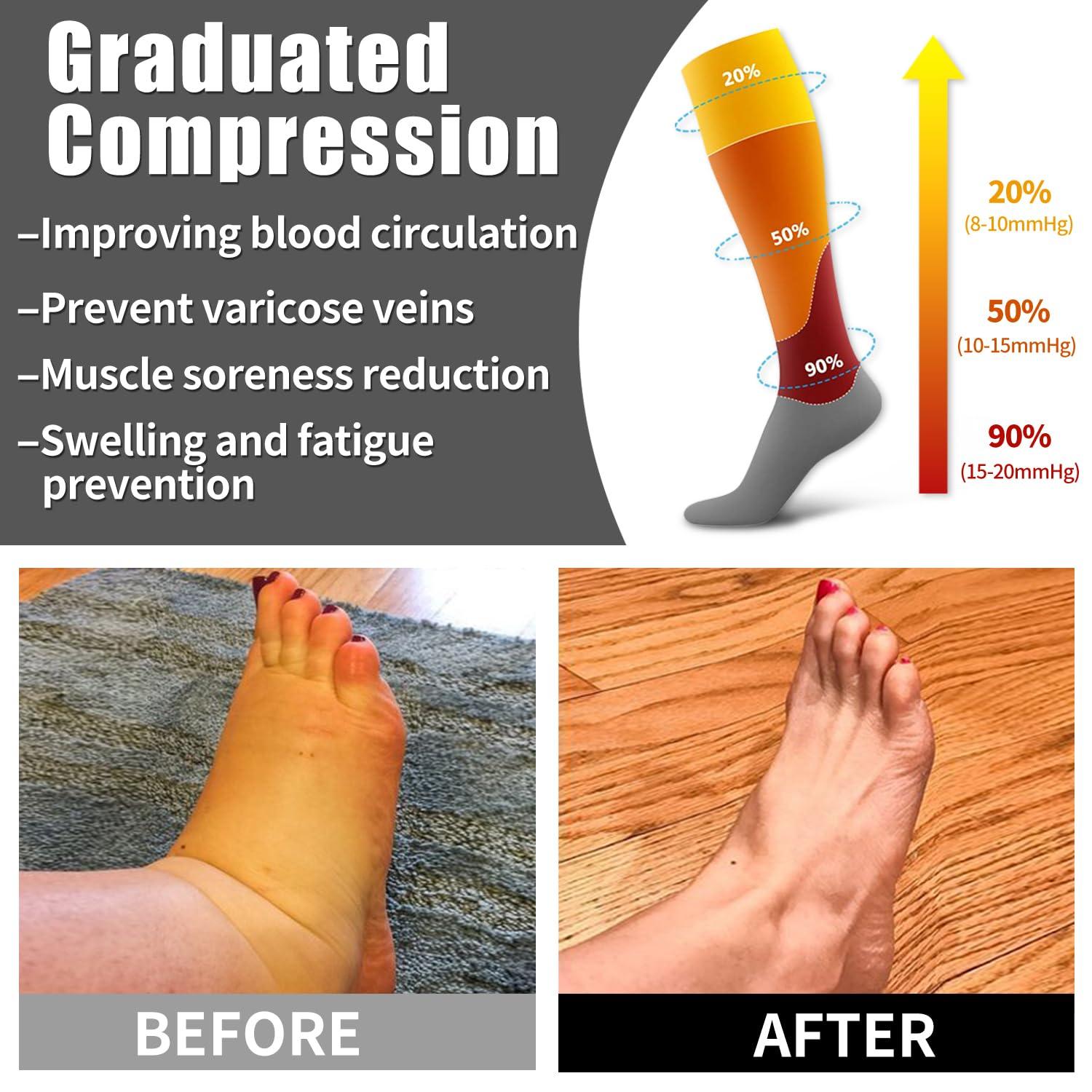 6pc Medical grade compression stockings for women men varicose veins relief swelling reduction diabetic socks circulation boost doctor recommended trending health product must have Color Pattern