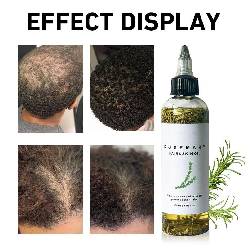 LANYAN 120ML Scalp Stimulating Hair Growth Oil, Light Mint & Peppermint Blend, Promotes Fuller Thicker Hair, Supports Hair Loss Repair