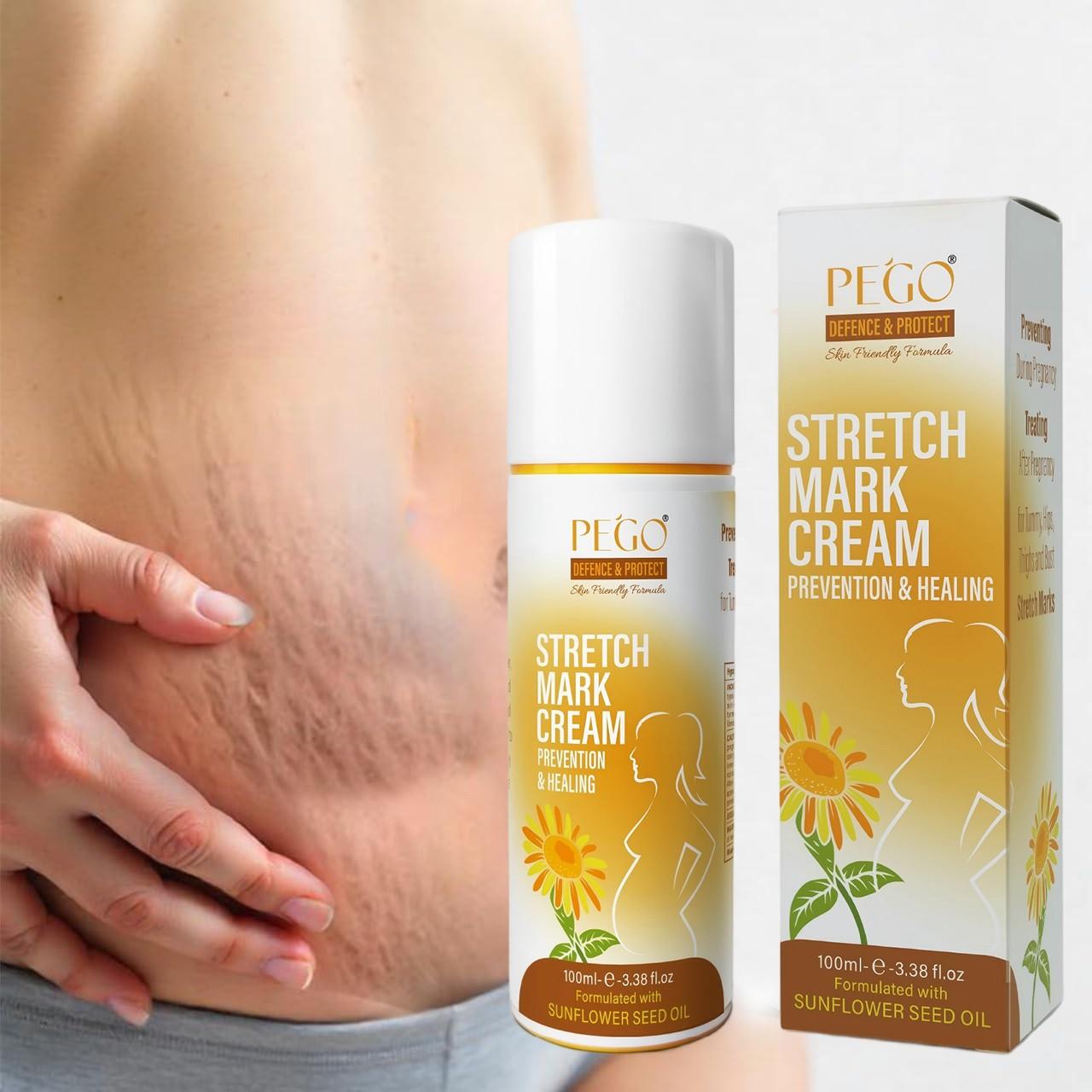 Gentle Repair Cream, Massage Balm, Firming Cream, Anti Stretch Marks, Reduces Stretch Marks, Prevents Pregnancy Belly Lines, Postpartum Recovery, Deep Moisturizing, Stretch Mark Cream For Pregnancy