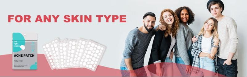 Pimple Patches for Face, Hydrocolloid acne Patches, 2 Size 180 Count Acne Patches, Spot Stickers with Salicylic Acid, Tea Tree Oil & Calendula Oil