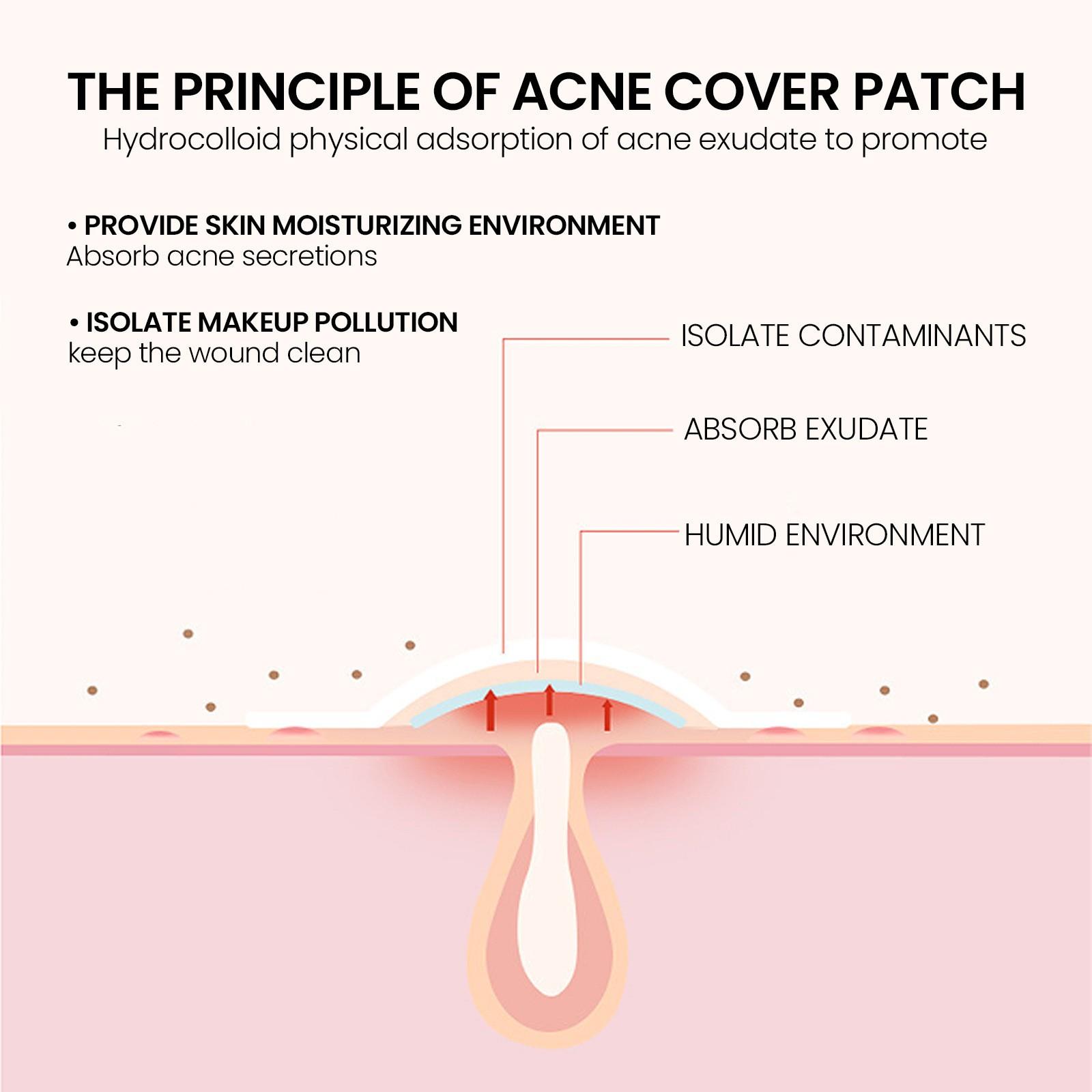 Acne patches, made of hydrocolloid material, cute star-shaped acne patches, colorful acne patches, containing tea tree oil, salicylic acid, and centella asiatica oil, 200 patches per pack, for skin care and repair.