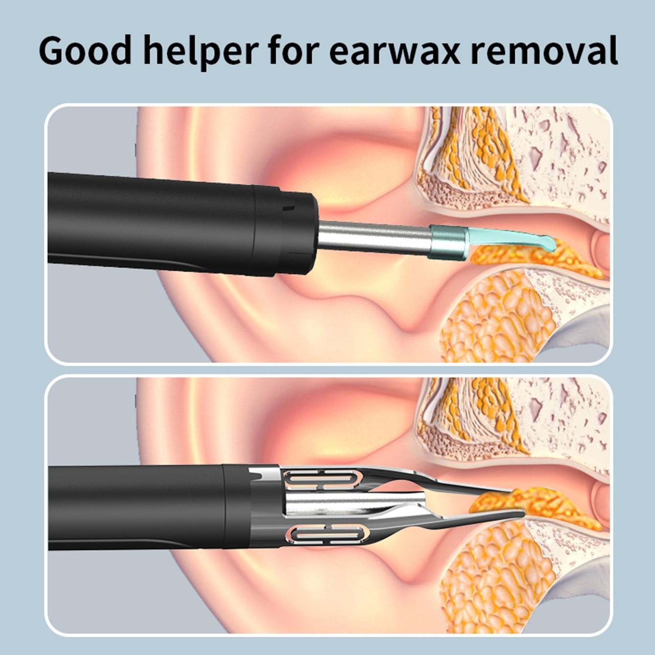 Ear cleaning tool | Visual ear pick, Ear Cleaner Camera, with 5 replaceable silicone soft tips, USB charging cable, a good gift