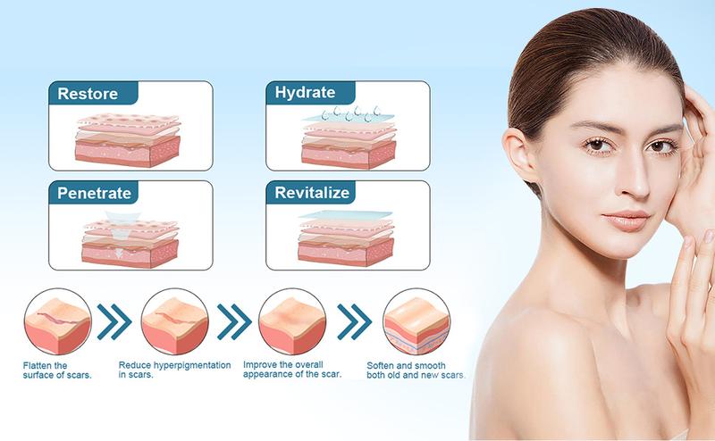 ANXINKANG Silicone Scar Gel, reduces the appearance of new and old scars from burns, stretch marks, surgery, trauma, keloids, etc., 0.70 oz (20g)