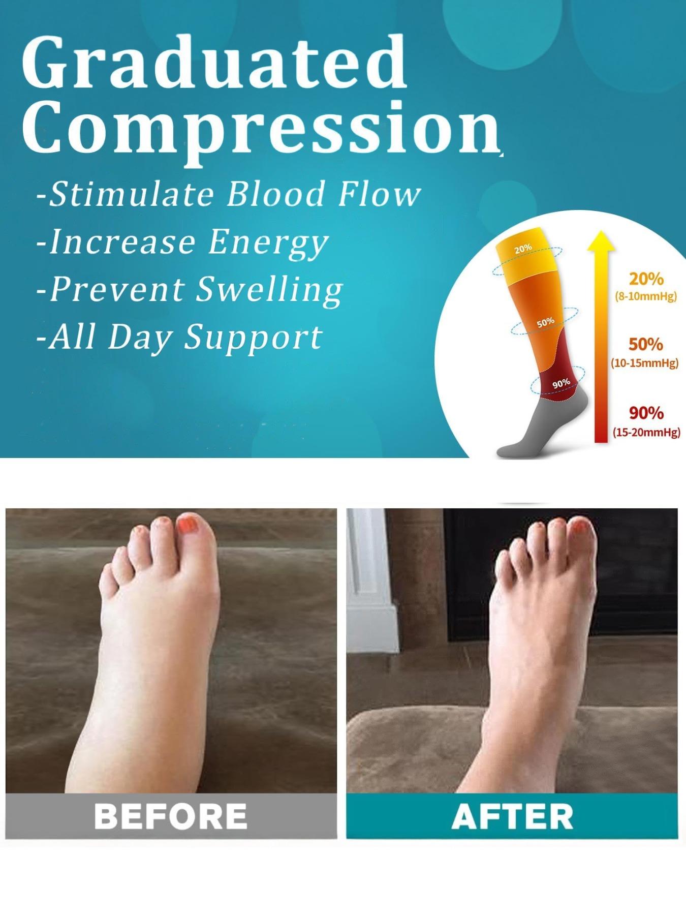 Unisex's Colorful Compression Socks, Sports Socks for Running, Nurses, Pregnant Women, Sports Socks for Improving Blood Circulation, Polyester Athletic Socks