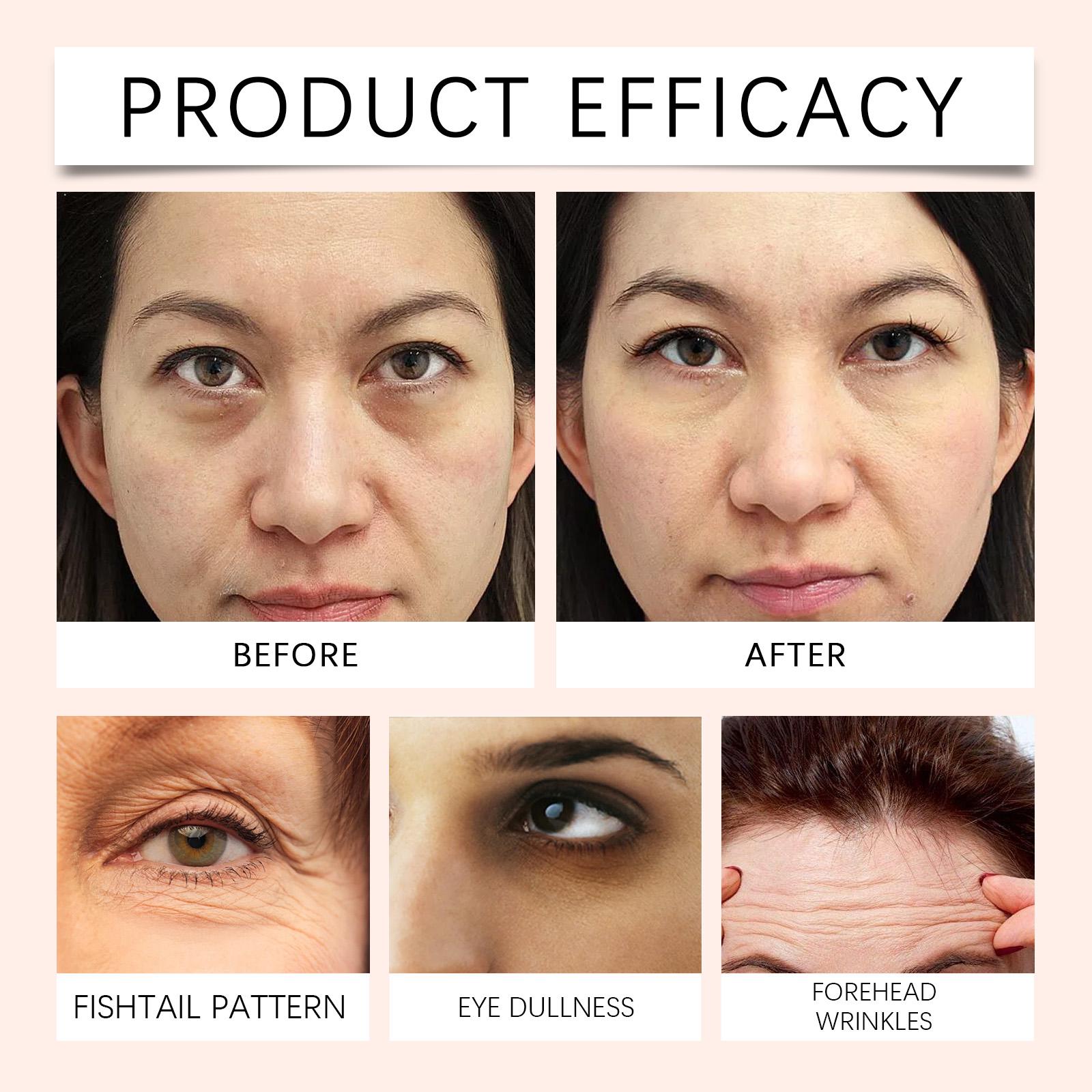 [NEW] The Peptide Collagen Hydrogel Eye Patch 60 Patches Reduce Puffiness Hydrate Under-Eye Bags in 10 Minutes