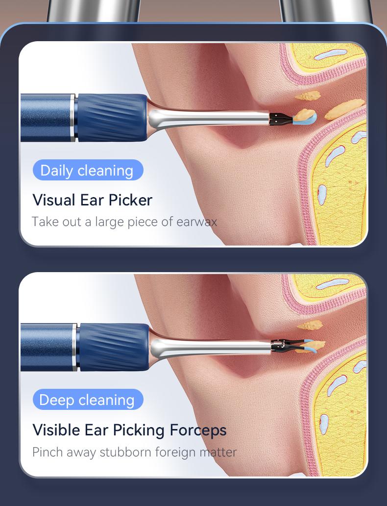 2026 Upgrade Silicone Ear Wax Removal Kit with 12 MP HD Camera, Portable 360° Wide-Angle Ear Cleaner, Type-C Rechargeable, Waterproof Endoscope for iOS & Android, Earwax Remover for Adults