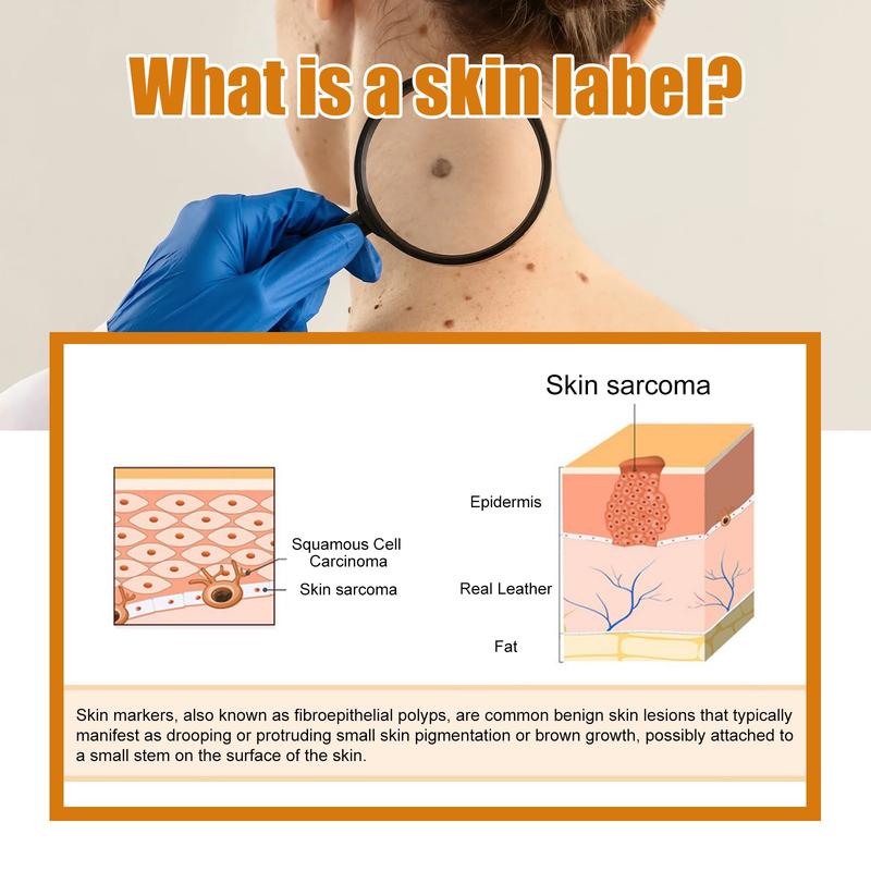 OUHOE Skin Tag Wart Remover Patches Tea Tree Oil Thuja Centella Asiatica Extracts Targeted Gentle Repair Soothing Hydrating Blemish Patches