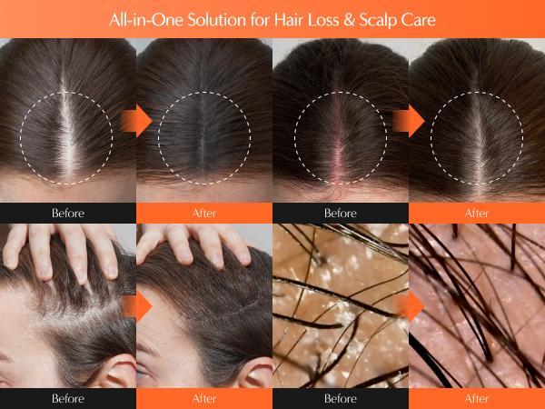 Lilyeve Growturn Hair Growth Serum with Built in Brush for Hair Growth & Thickening Lilyeve Growturn Hair Growth Serum with Built in Brush for Hair Growth & Thickening