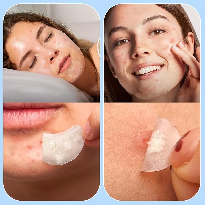 104pcs Acne Patches, Acne Pimple Patch, 5 Shapes, Hyaluronic Acid & Tea Tree Oil, Day and Night Skin Care, Transparent Gel, Anti-Acne Treatment