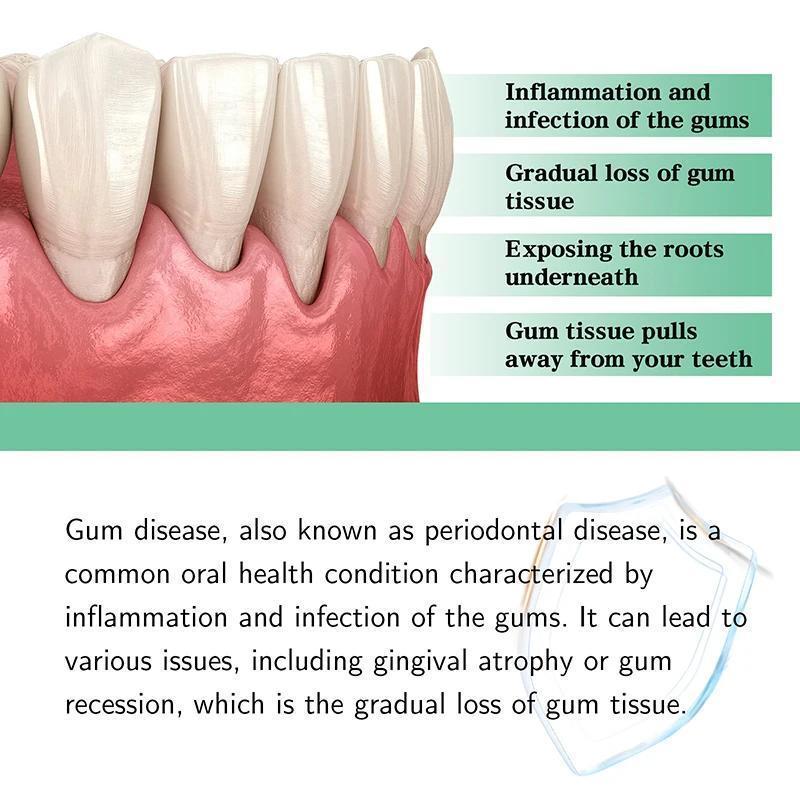 30ml Gum Repair Drops Relieve Receding Gingival Swelling Gum Cleaning Oral Periodontal Hygiene Remove Stain Remove Yellow Tartar
