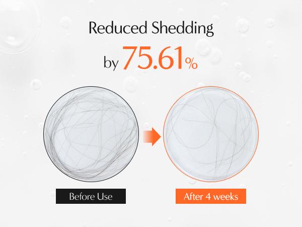 Lilyeve Growturn Hair Growth Serum with Built in Brush for Hair Growth & Thickening