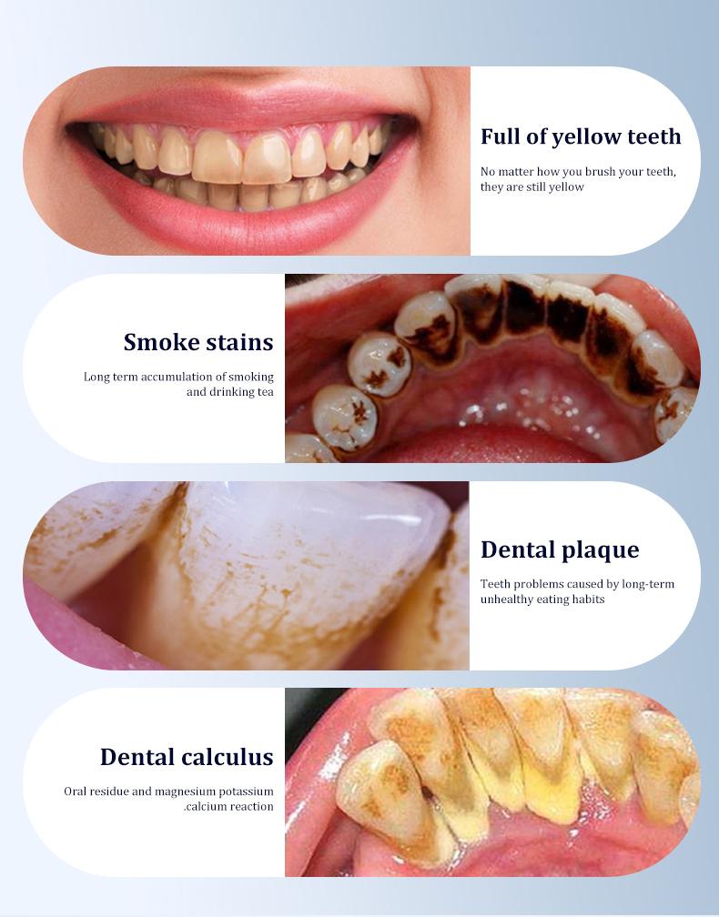 [Holiday Haul] Professional Teeth Cleaning Kit – 5 Modes for Removing Stains, Plaque & Tartar, with Mirror and Extra Brush Heads, Perfect for Beginners & Sensitive Teeth