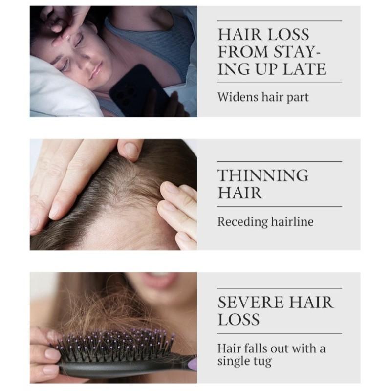 5% Minoxidil Hair Growth Set | Hair Serum / Shampoo / Conditioner / Scalp Massage Balm, Sold Separately or as a Kit. Activate Hair Follicles, Anti-Hair Loss, Repair Damaged Hair, Improve Hairline, Professional Hair Care Solution