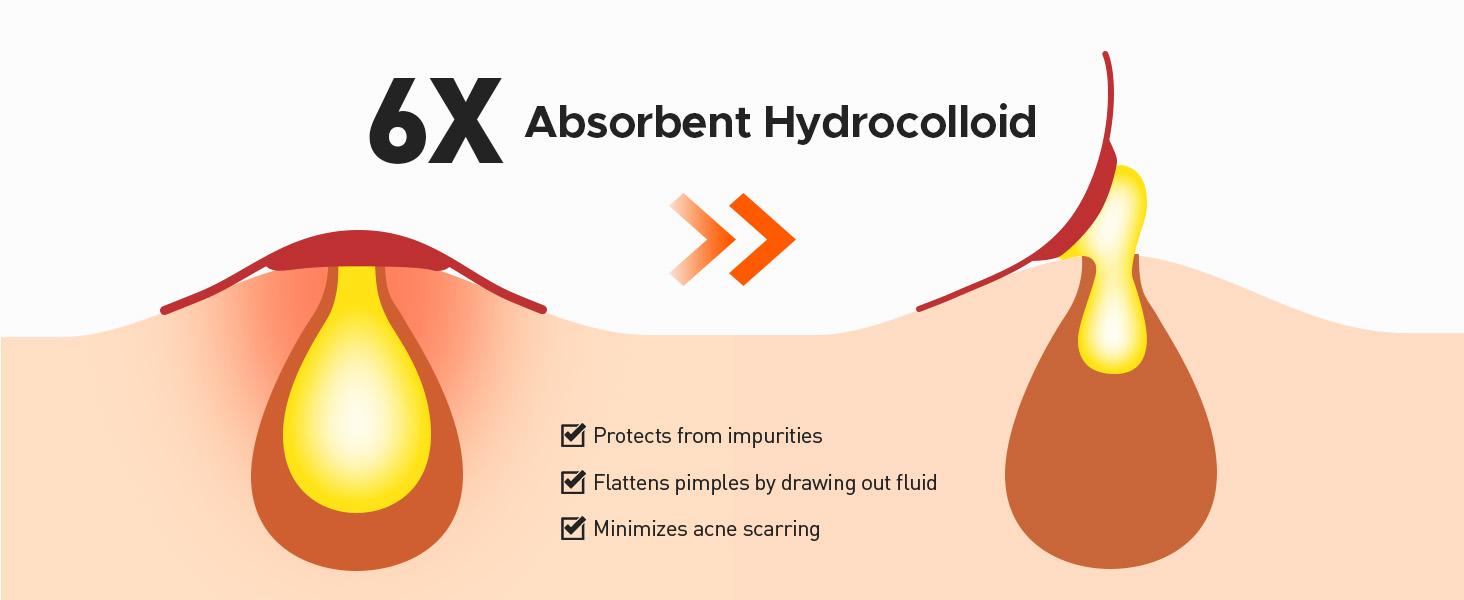 TKTK  Large Pimple Patches for Face(Strip, Contoured, Dot 5 Sizes 300 Count) , Acne Patches 60 x 20 mm, XL Hydrocolloid Bandages for Forehead,Chin,Full Face,Back,Neck and Body Skincare,acne clearing products,pimple patch #SpringStatements