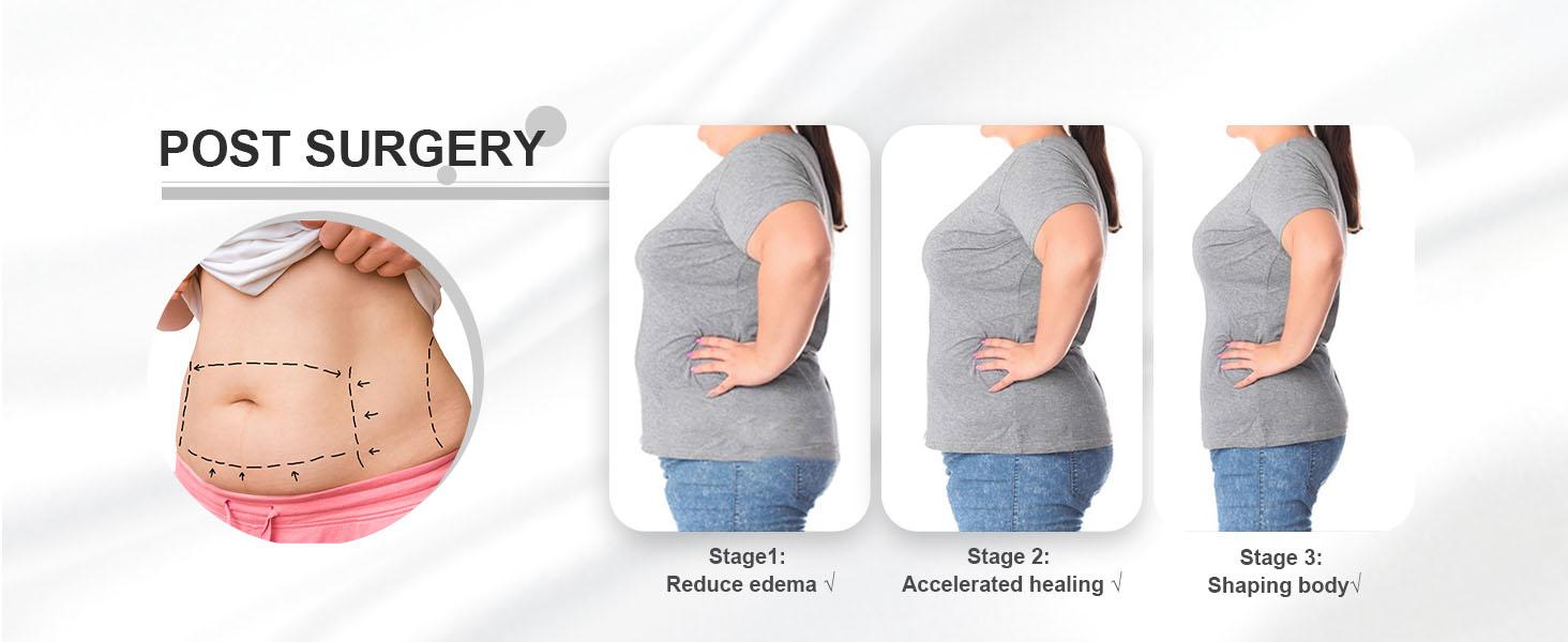 JOSHINE SHAPER Fajas Moldeadoras Shapewear Tummy Control Full Body Shaper Post Surgery Compression Garment with Invisible Zipper & Adjustable Hooks for Women Soft Adjustable Bodysuit Clothes Lace Valentine's Day Gifts JOSHINE SHAPER Fajas Moldeadoras Shapewear Tummy Control Full Body Shaper Post Surgery Compression Garment with Invisible Zipper & Adjustable Hooks for Women Soft Adjustable Bodysuit Clothes Lace Valentine's Day Gifts