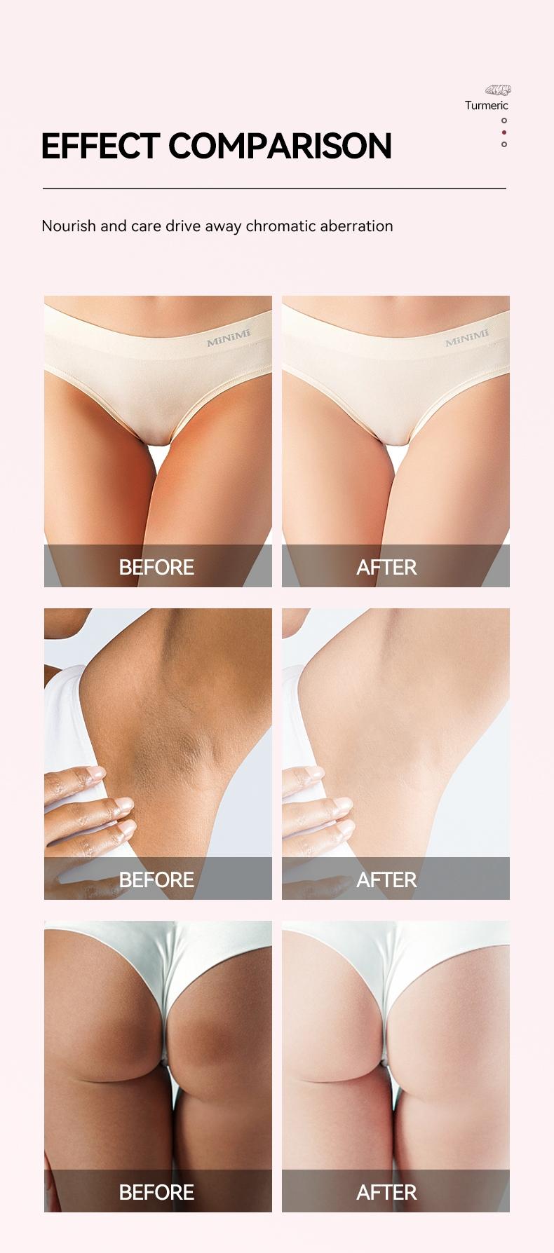 150g Brightening Bikini Scrub, Gentle Exfoliating Dark Spot Removal, Private Area Smooth Moisturizing Care, Skin Nourishing Treatment