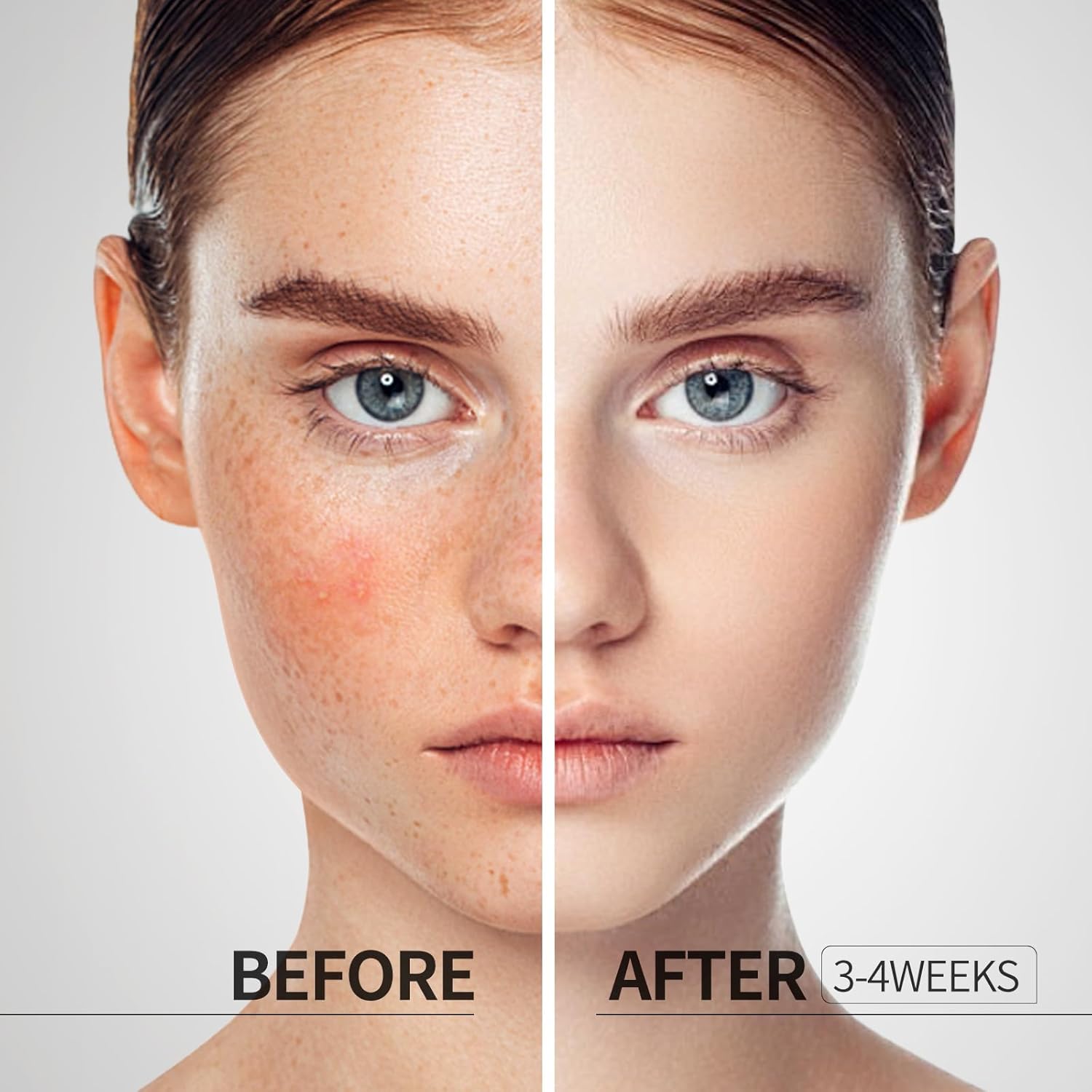 HANYWIL Vitamin C Gold | Anti-Aging Vitamin C Serum for Firming, Lifting & Hydrating Mature Skin | Dark Spot Correcting Serum for Skin Discoloration with Hyaluronic Acid | Suitable for all skin types cozyvibes effortlessbeauty fathersdaygifts HANYWIL Vitamin C Gold | Anti-Aging Vitamin C Serum for Firming, Lifting & Hydrating Mature Skin | Dark Spot Correcting Serum for Skin Discoloration with Hyaluronic Acid | Suitable for all skin types cozyvibes effortlessbeauty fathersdaygifts