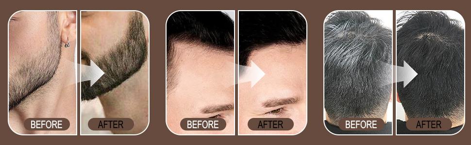 4 Count Hairline Powder Kit - Root Touch Up and Filler for Women, Hair Color Powder with Brush for Hairline Daily Ash Brown Blonde Balayage